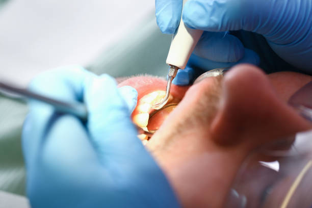 Best Emergency Dentist for Knocked-Out Tooth in Penn Valley, CA
