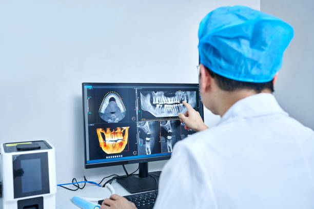 Best Emergency Dental Extractions in Penn Valley, CA